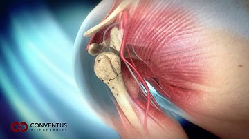 Proximal Humerus Animation