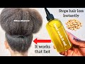 STOP HAIR LOSS INSTANTLY with Chick peas Oil for hair growth. Chickpeas Oil for hair! It Works fast