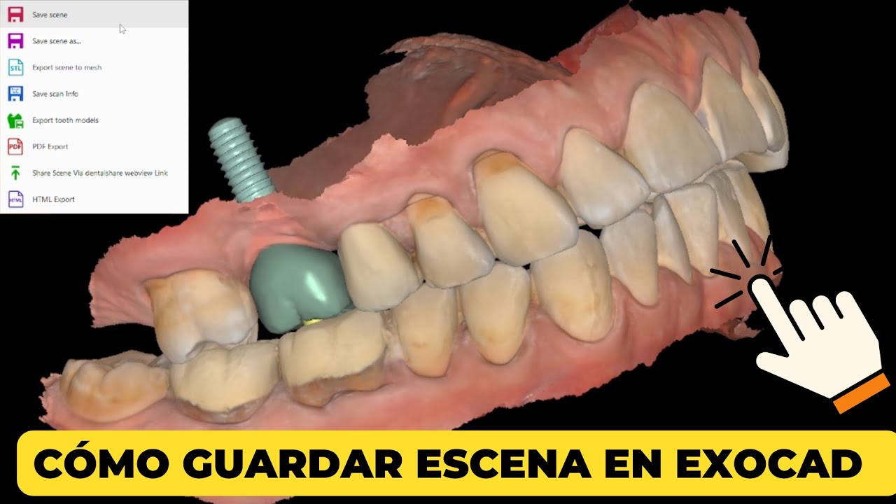 cómo guardar escena en exocad