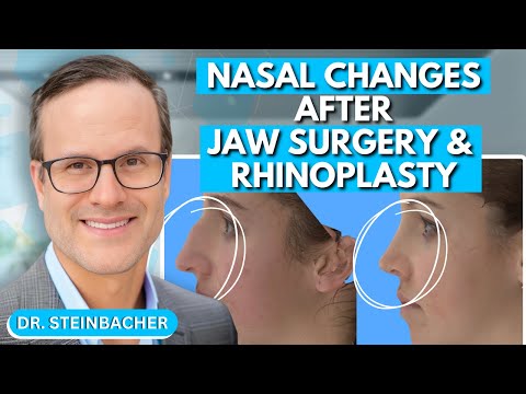 Video thumbnail: Nasal Changes After Orthognathic Jaw Surgery and Rhinoplasty | Dr. Derek Steinbacher — Dr. Derek Steinbacher