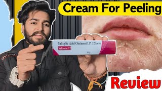 Skin Peeling Ointment Salicylic Acid 12% Cream | Salitone 12 Cream Review