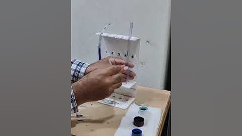 Demonstration of Baricity spread in Intrathecal space by Dr Tarun Vaghela