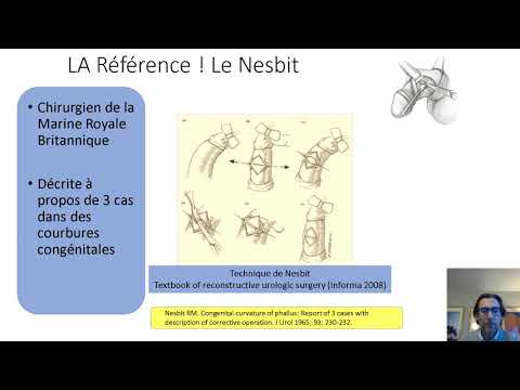 Vidéo: Verge D'or - Propriétés Bénéfiques Et Utilisations De La Verge D'or. Verge D'or Hybride, Canadienne, Ordinaire, Verge D'or, Josephine, Solidago