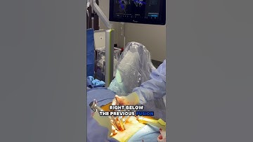 #AI Surgery Follow-Up