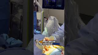 #AI Surgery Follow-Up