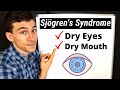 What is Sjögren's Syndrome? Eye Doctor Explains