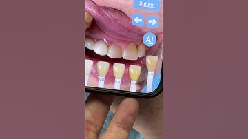 using the digital shade guide in the LSK121 App for cosmetic dentistry again in my lab today