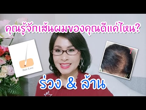 คุณรู้จักเส้นผมของคุณดีแค่ไหน? : ร่วง & ล้าน