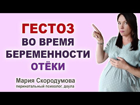 Почему опасен ГЕСТОЗ? Отеки при беременности.