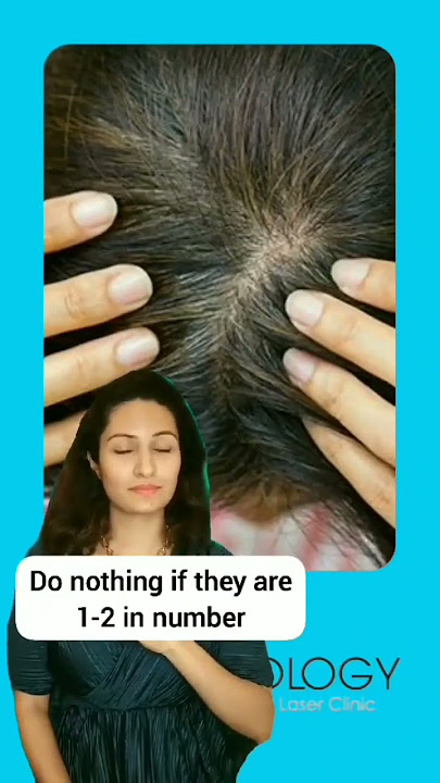 ✨First thing to do when you see premature White Hair✨