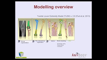 [Webcast] GrandChallenge Knee: Patient-Specific Musculoskeletal Modelling Of Total Knee Arthroplasty