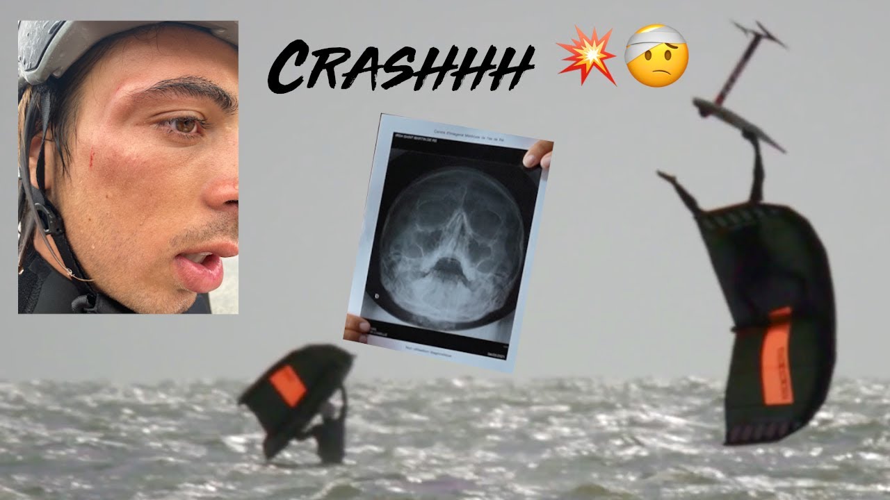 CAMS SE COGNE LA TÊTE EN BACKFLIP!!! 🥵