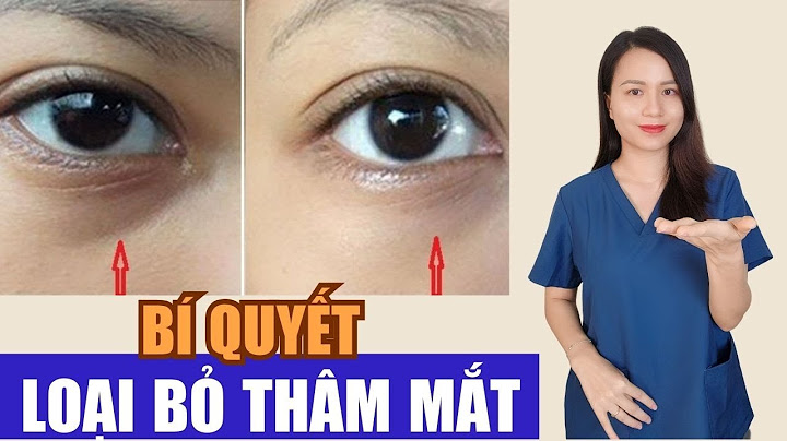 Làm thế nào để hết quầng thâm mắt năm 2024