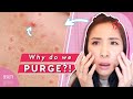 Which Products Cause Skin Purging? 🌋 Tips for All Skin Types