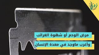 مرض الوحم أو شهوة الغرائب ... وأغرب ماوجد في معدة الإنسان !! || قناة زدني