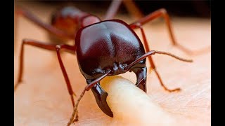 Самый болезненный укус насекомых. Топ 10 самых болезненных укусов насекомых.