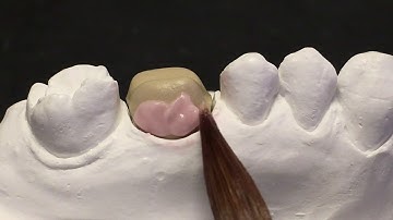 EX-3 SPEED ENAMEL: una sola cottura bi-strato