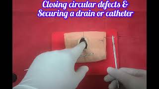  Purse string sutures 🪡