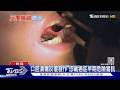 反覆嘴破不是火氣大? 醫師警告超過兩週沒好  快就醫｜十點不一樣20260619 @TVBSNEWS01