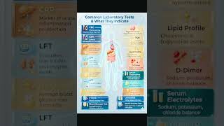 Common lab test every Doctor must know #facts #irfanvlog #doctor