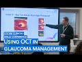 How to use oct for glaucoma management