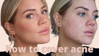 How to cover acne, redness & scarring | Elanna Pecherle 2021