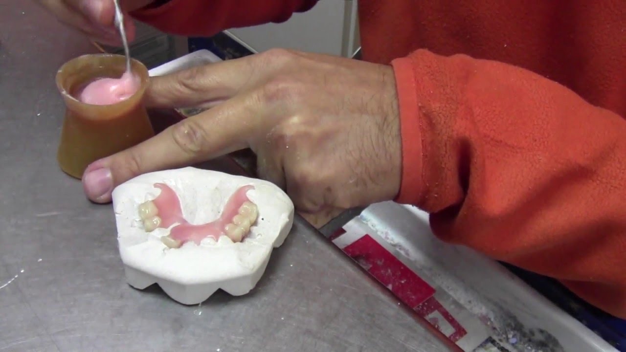 Reparação de prótese acrílica