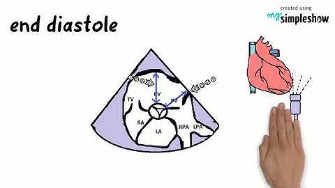HEART&TECHY-RIGHT VENTRICULAR SIZE AND FUNCTION IN ECHO PART 1