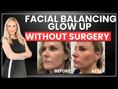 Video thumbnail: Face Balancing Transformation with Filler – You Won’t Believe the Before & After! · The Spiegel Center