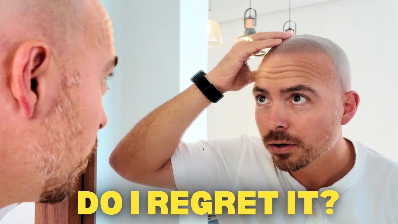 Мне сделали микропигментацию кожи головы в Мексике...