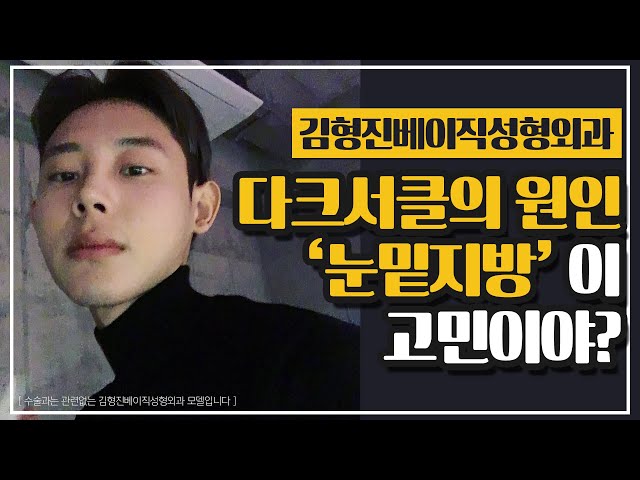 다크서클원인 눈밑지방, 재배치수술부터 눈밑지방이식 그리고 재수술까지( ++ 눈밑지방재배치vs하안검 )