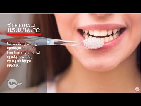 Video: Ինչու ատամներ քաշելը նման չէ դրանց արդյունահանմանը
