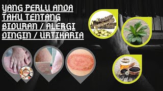 Yang perlu anda tahu tentang Biduran / Alergi Dingin / Urtikaria