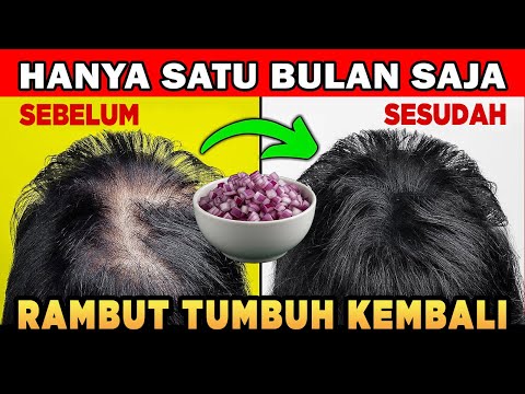 Ramuan Herbal Agar Rambut Cepat Panjang