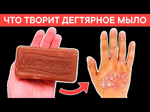 Вот что творит ДЕГТЯРНОЕ МЫЛО с телом! 90 пользующихся НЕ ЗНАЮТ об этом!