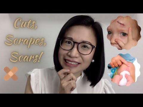 Cuts, Scrapes and Scars in Kids: How to Make Wounds Heal Properly | Dr. Kristine Alba Kiat