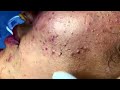 Fascinating Your Day With Sac Dep Spa 2022 332 Fascinating Your Day With Sac Dep Spa 2022 332