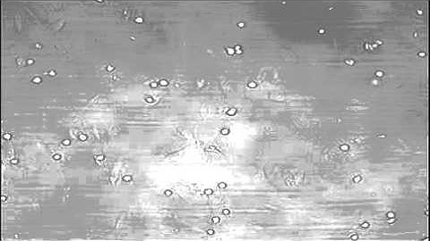 Inflammation - Atherosclerosis:  THP-1 monocytes adhering to HUVECs in biochip under flow