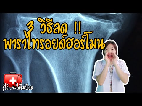 อันตรายจากฮอร์โมนพาราไทรอยด์สูง ในคนไข้ไตวาย|รู้ไว้จะได้ไม่ป่วย|ไตวายเรื้อรัง|ฟอกไต