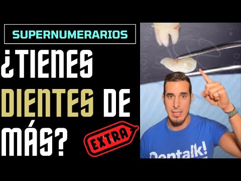 Video: ¿Los dientes supernumerarios son genéticos?