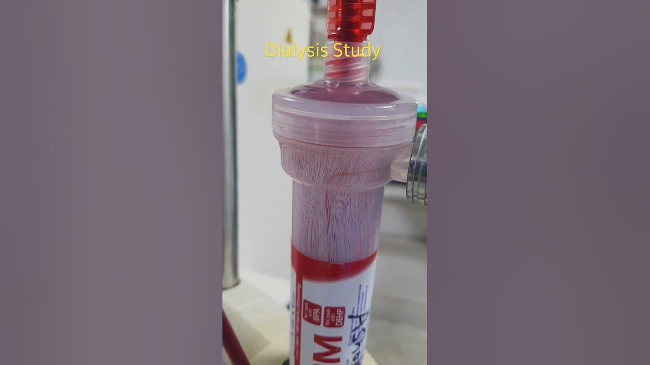 blood-leak-from-dialyzer-during-dialysis-dialysis-nephrology