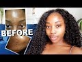 My Updated Skincare Routine 2018