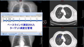 CARESTREAM Vue PACS Registration & Lesion Management機能