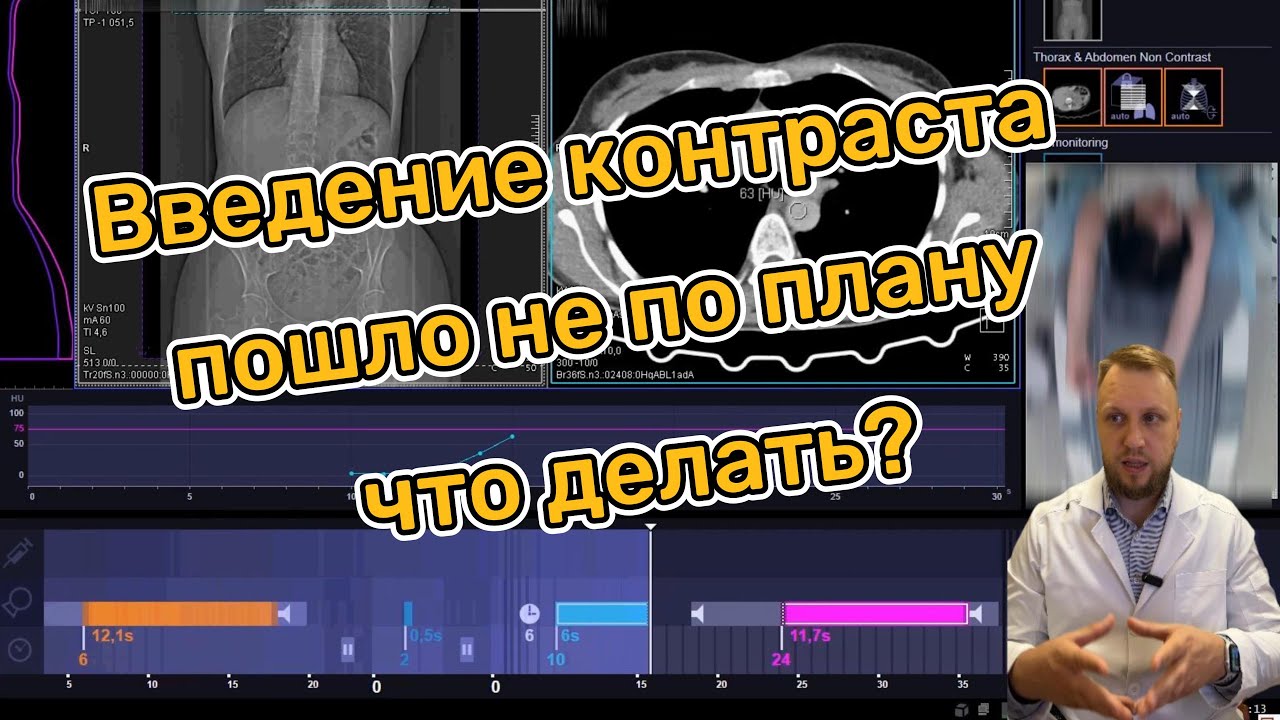 Введение контраста на КТ пошло не по плану. Что делать? CT Siemens Go.