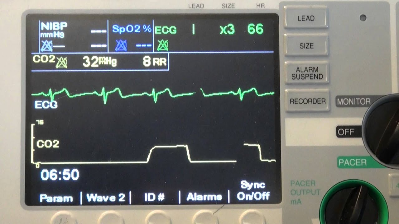 Ventilation - A Special Report (Revised) - YouTube