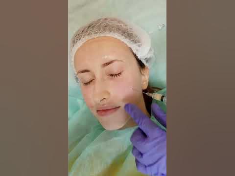 НОСОСЛІЗНА БОРОЗНА - YouTube