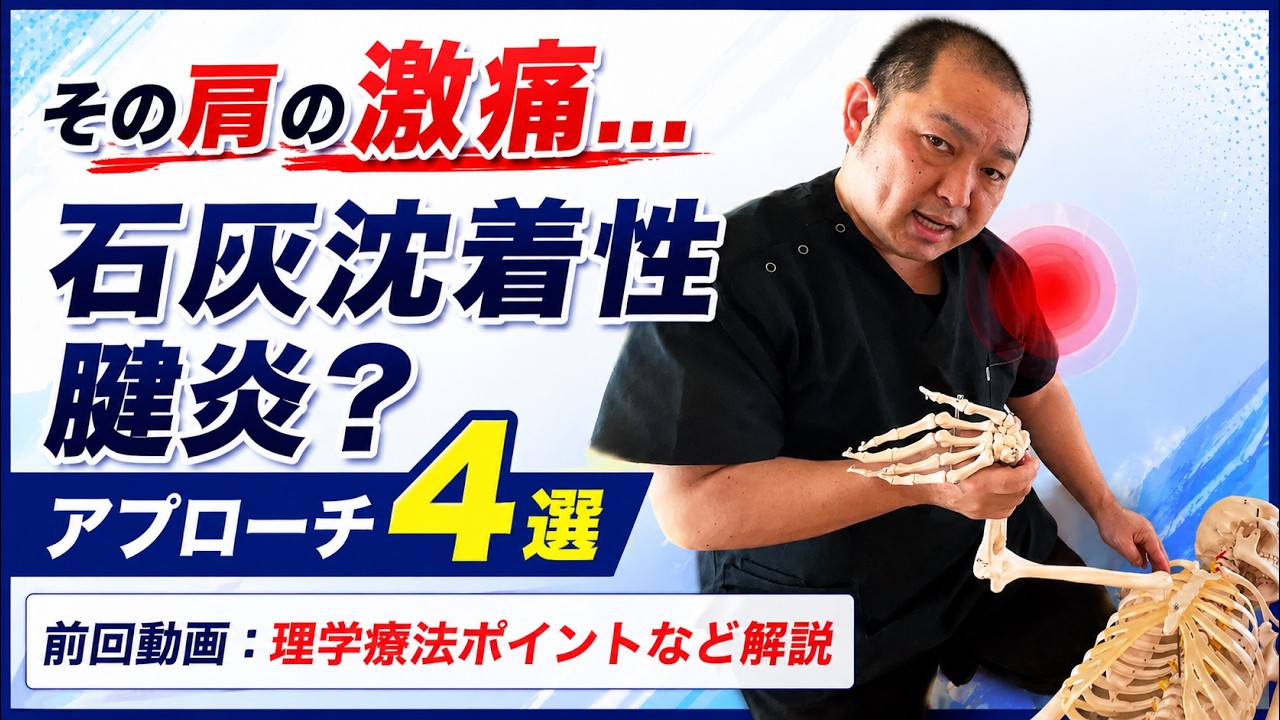 【実技編】肩に激しい痛みが出現した場合～石灰沈着性腱炎に対してのアプローチ4選～