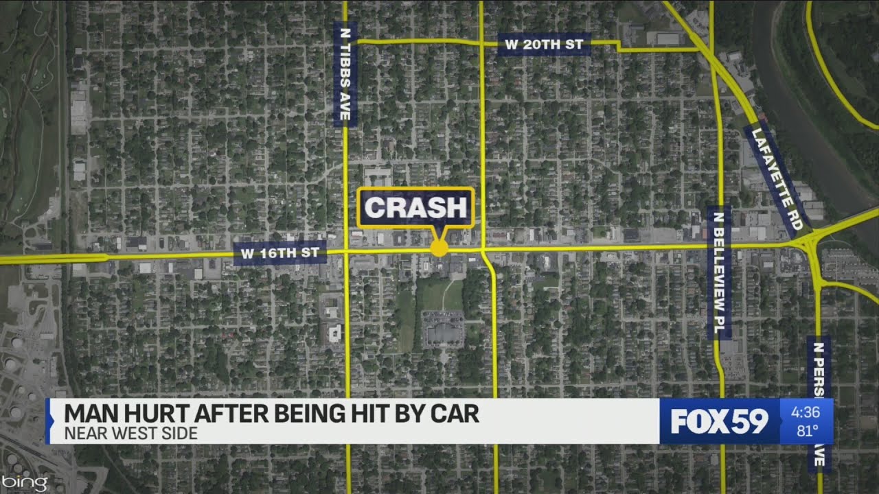 Man critically hurt after being hit by car - YouTube