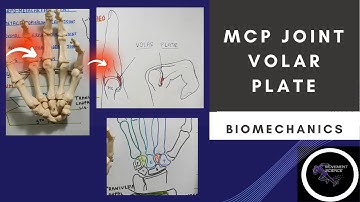 MCP JOINT - VOLAR PLATE( HAND  COMPLEX BIOMECHANICS)Physiotherapy