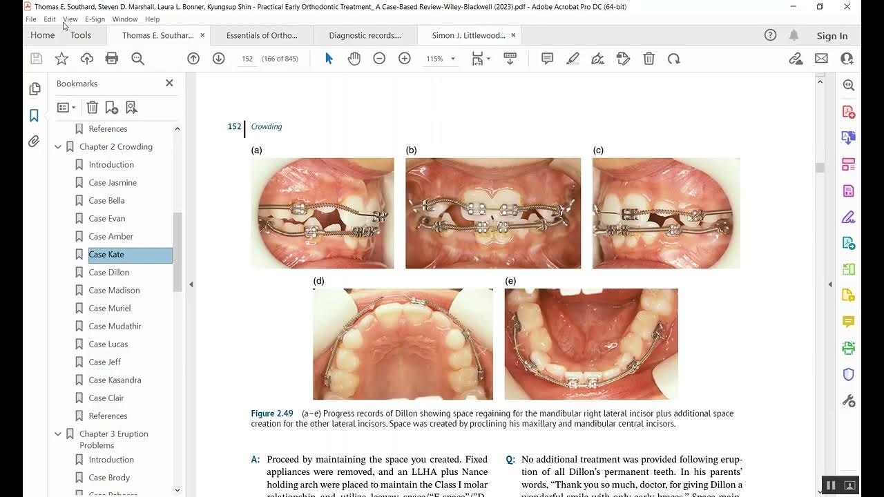 Orthodontic Diagnostic Records Part 1 المرحلة الخامسة YouTube